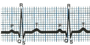 Graphic showing peak-to-peak heart beat